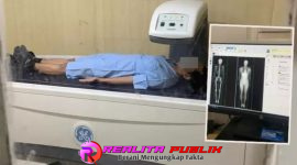 layanan Bone Mineral Density (BMD) atau DEXA Scan (Realita Publik)