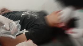 Gugur Saat Bertugas, Anggota Polda Lampung Tewas Ditembak Pelaku Curanmor. 