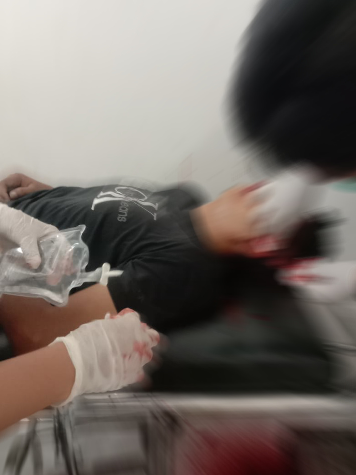 Gugur Saat Bertugas, Anggota Polda Lampung Tewas Ditembak Pelaku Curanmor. 